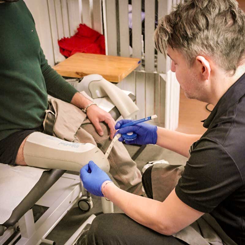 Der Prozess beim Maßnehmen für eine Beinprothese – Orthopädietechniker in Hamburg tastet den Stumpf ab und markiert maßgebende Punkte, während der Patient sitzt und die zukünftige Passform des Prothesenschafts sorgfältig geplant wird